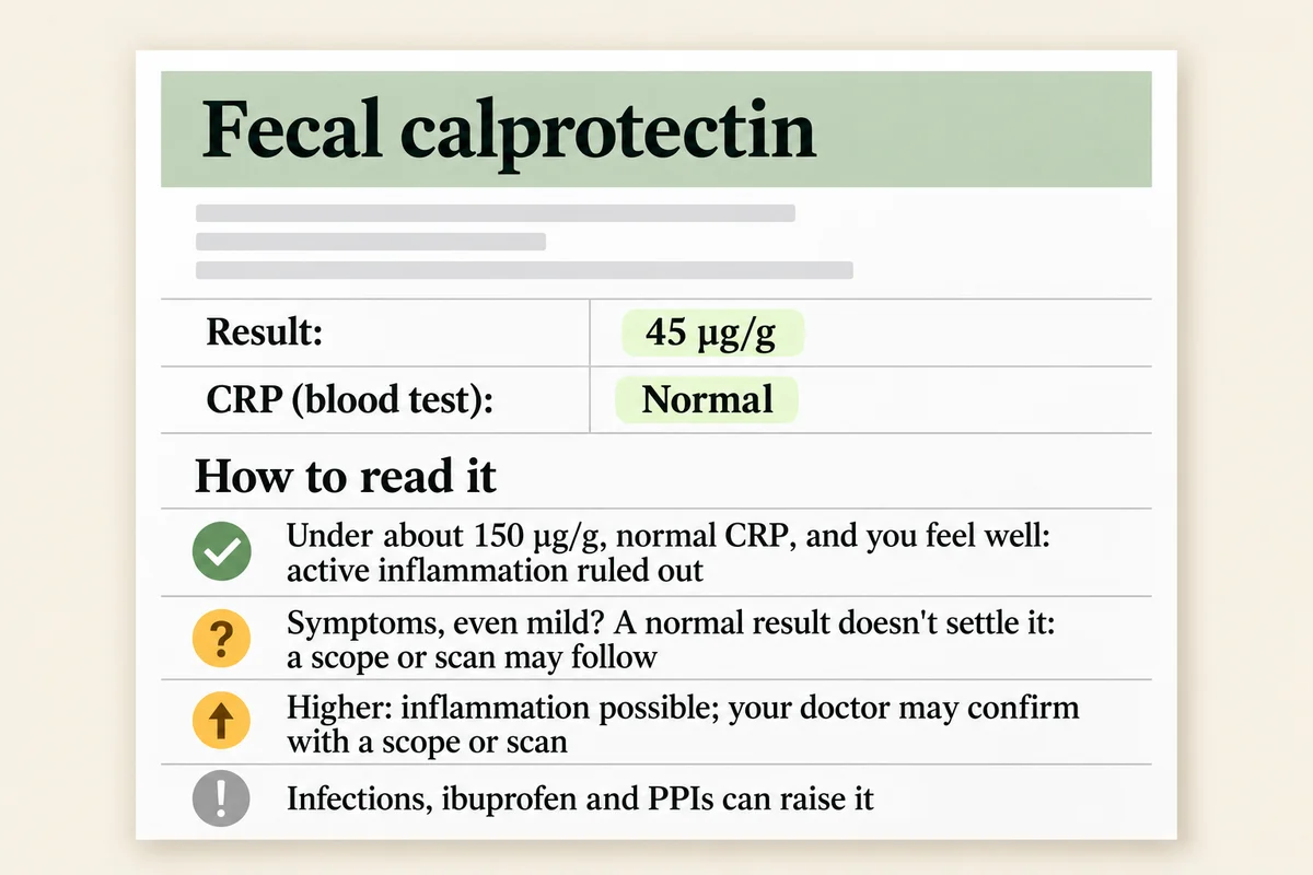 Sample stool-test result card for fecal calprotectin showing 45 µg/g and a normal CRP, with a three-line guide to reading the result