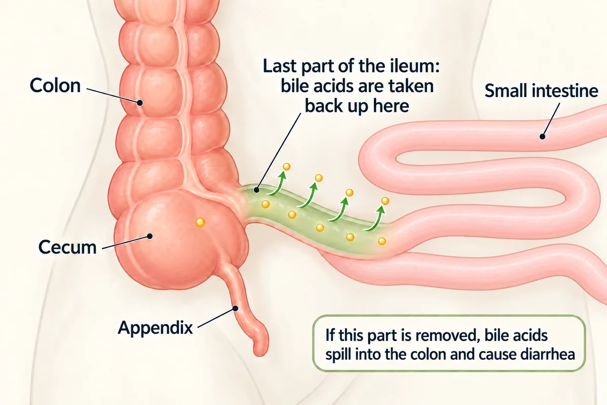 Diagram of the lower right belly: the ileum, the end of the small intestine, joins the colon just above the cecum; its last stretch is shaded green where bile acids are taken back up